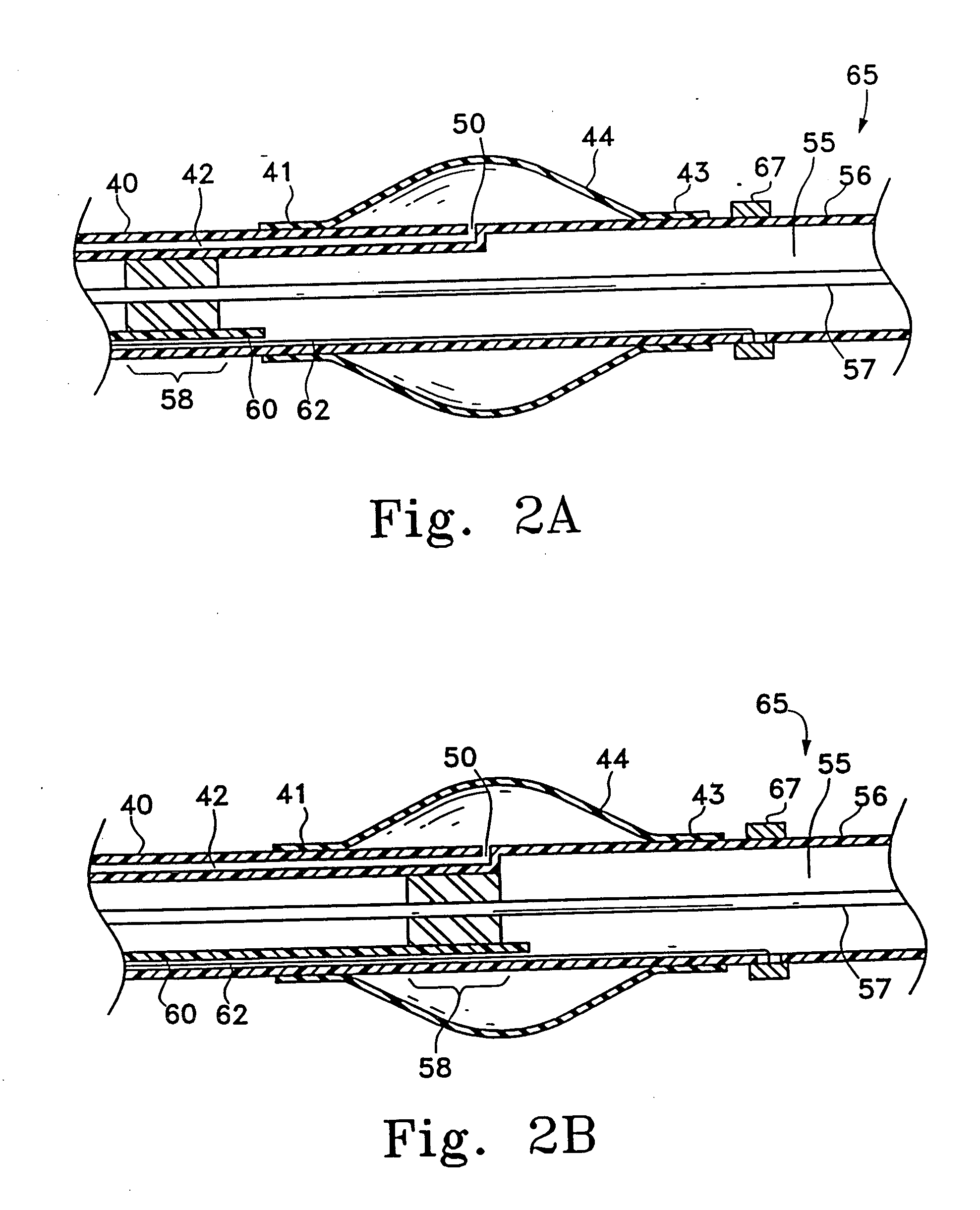 Long nose manipulatable catheter