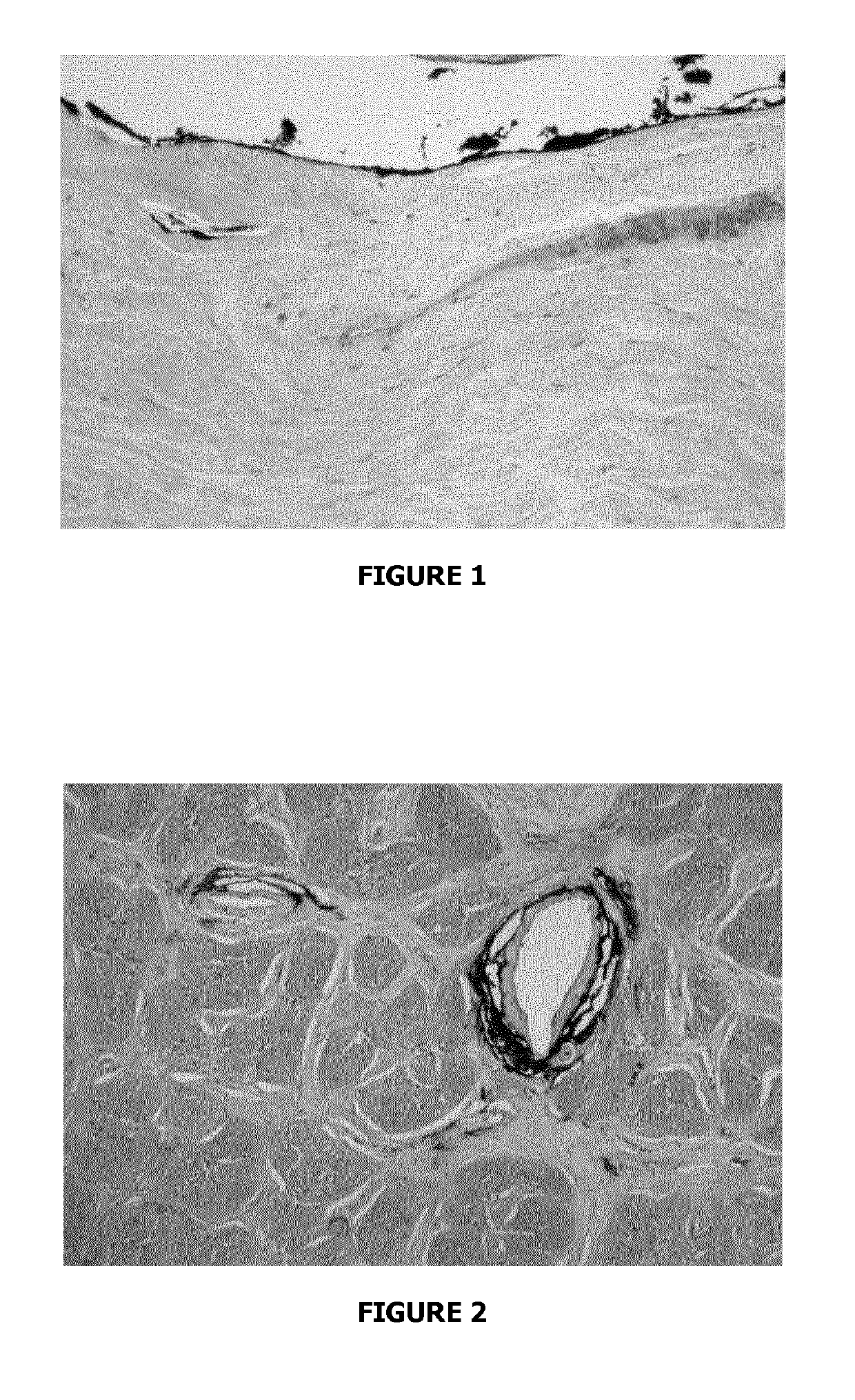 Compounds for use in methods for treating glaucoma and retinal diseases