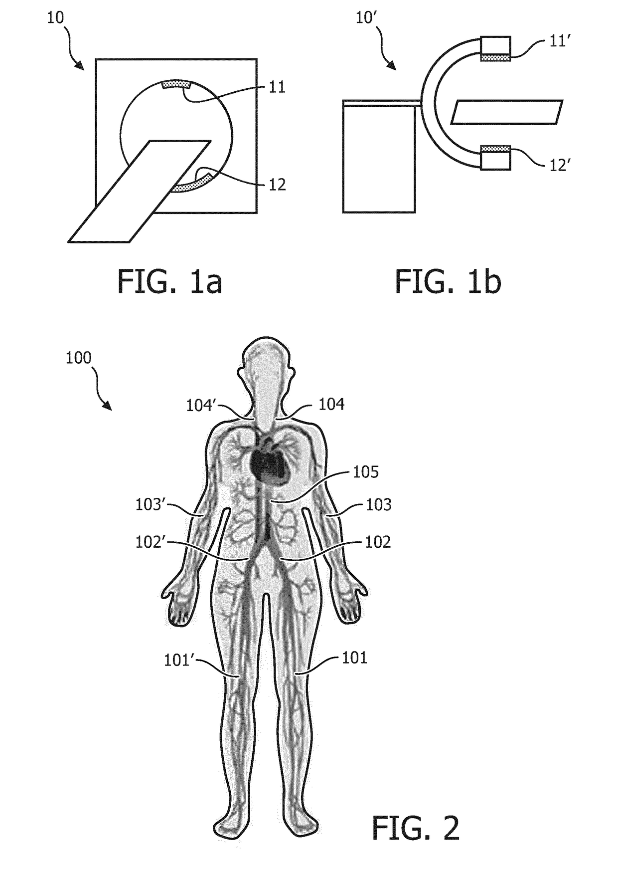 Stenosis assessment