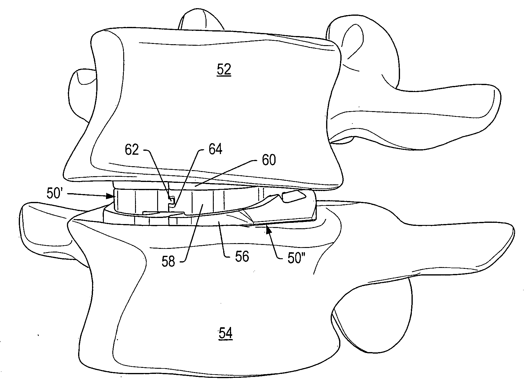 Dynamic interbody devices