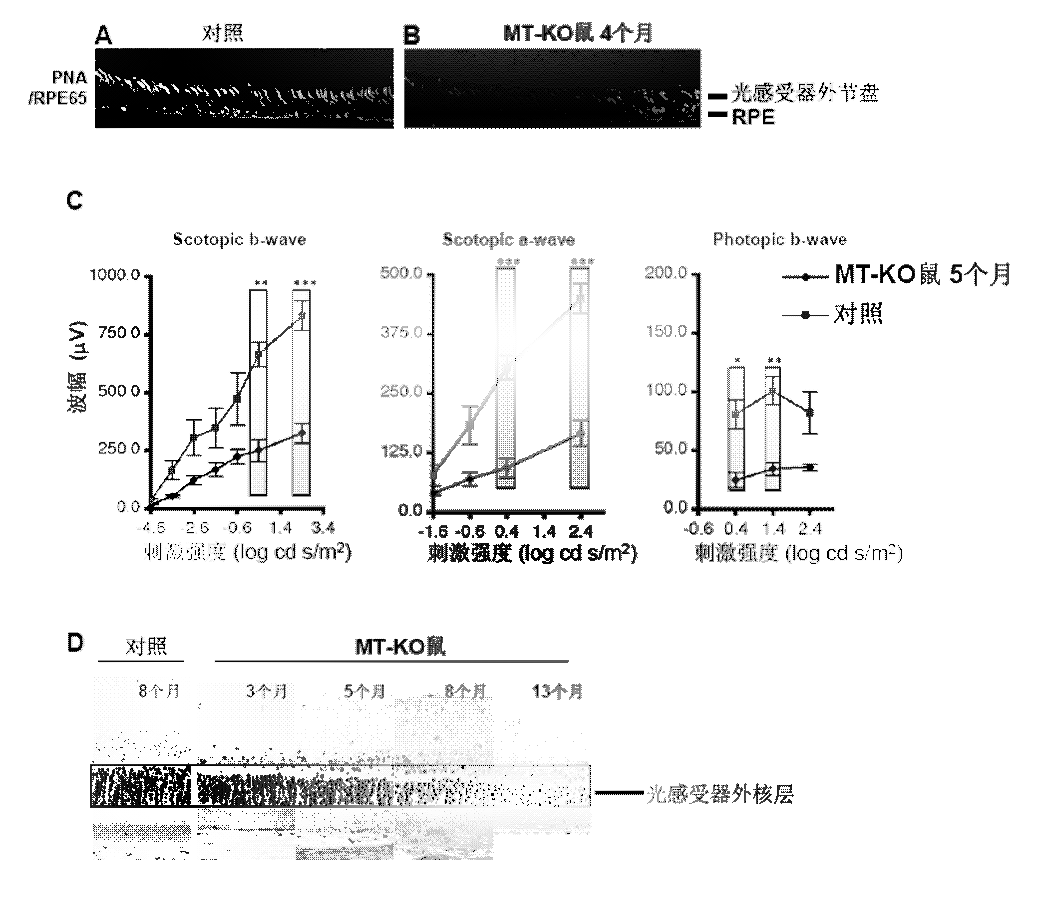 Rapamycin microemulsion injection for eyes and preparation method and application thereof