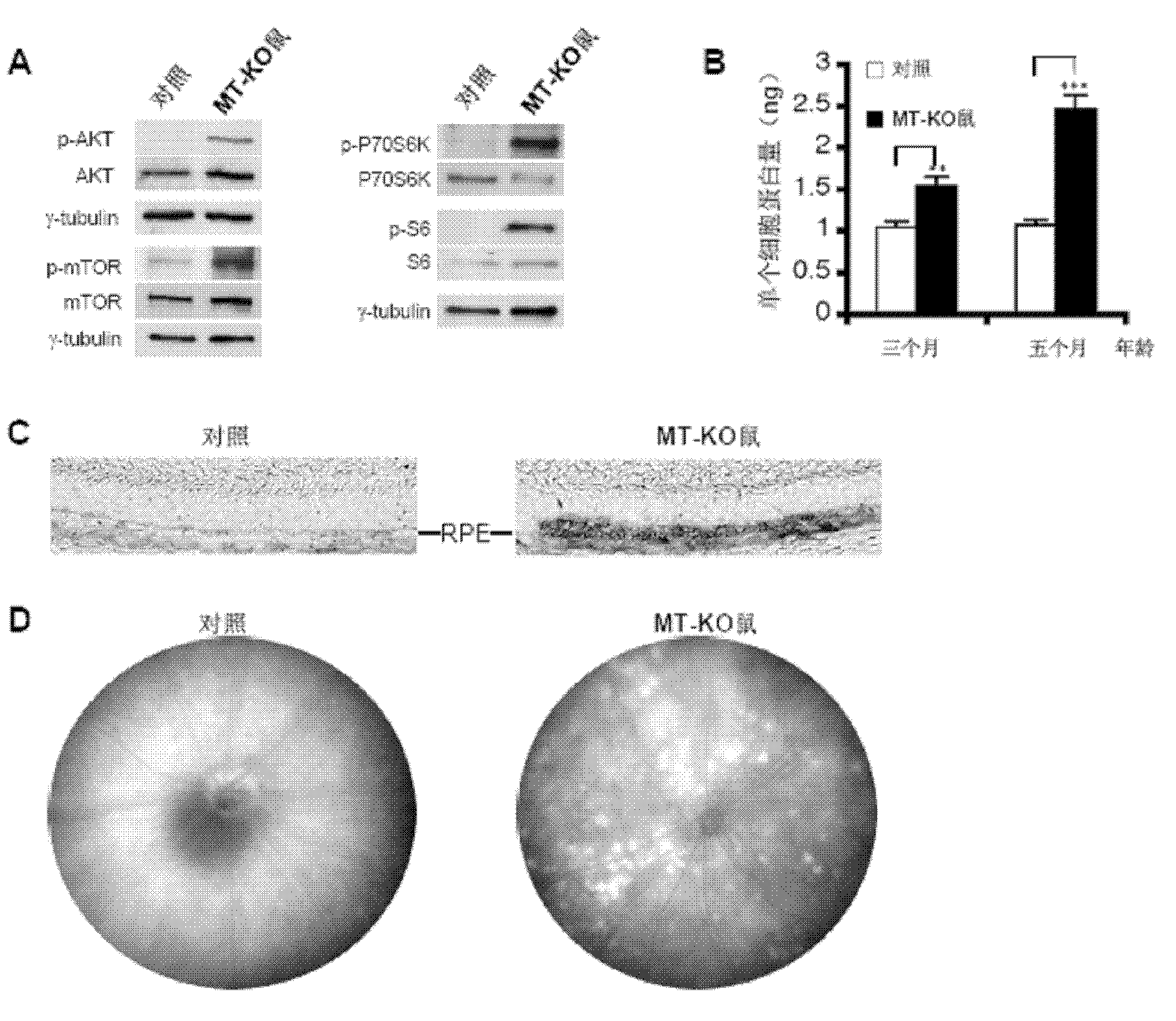 Rapamycin microemulsion injection for eyes and preparation method and application thereof