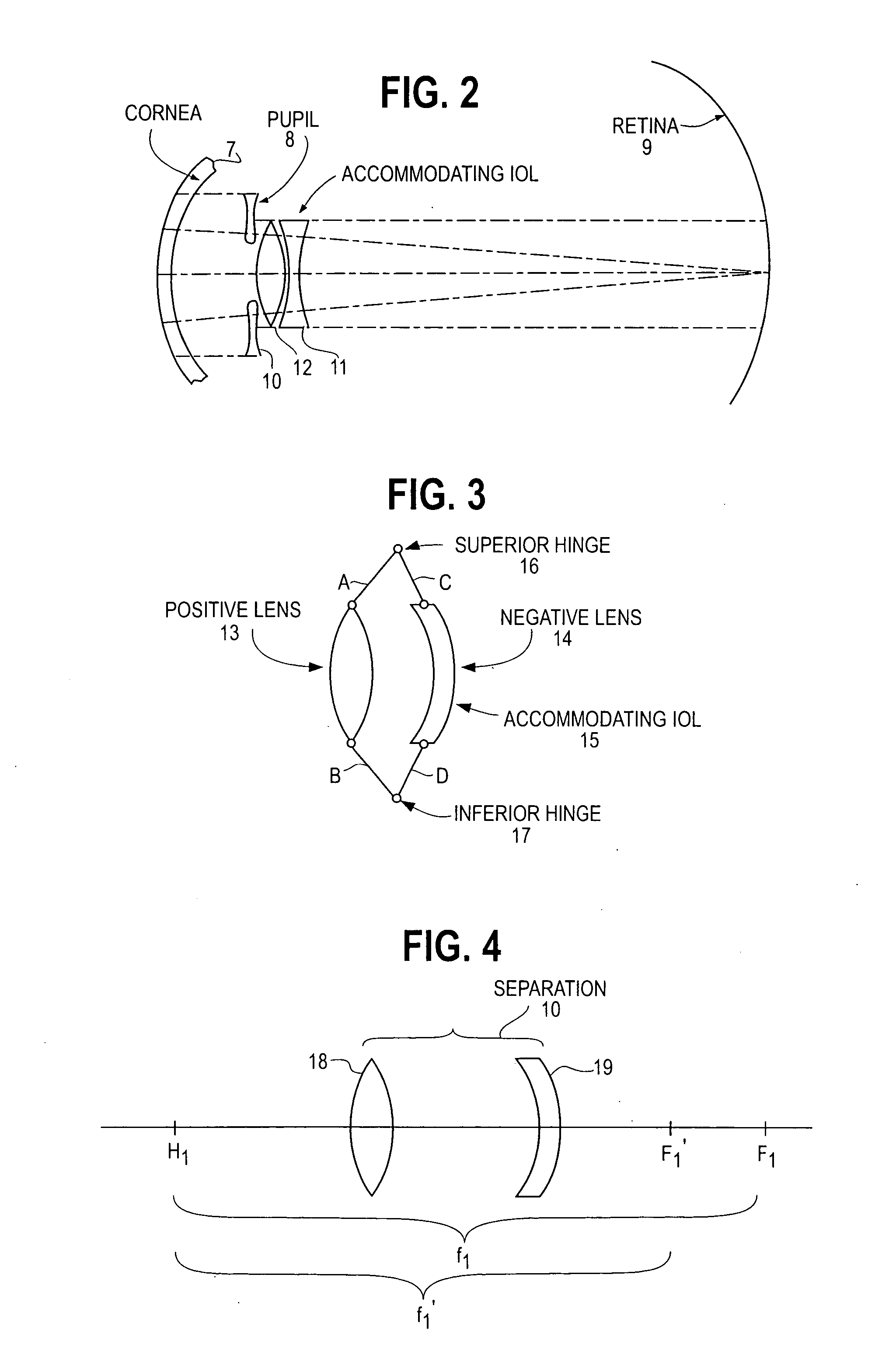 Accommodating intraocular lens