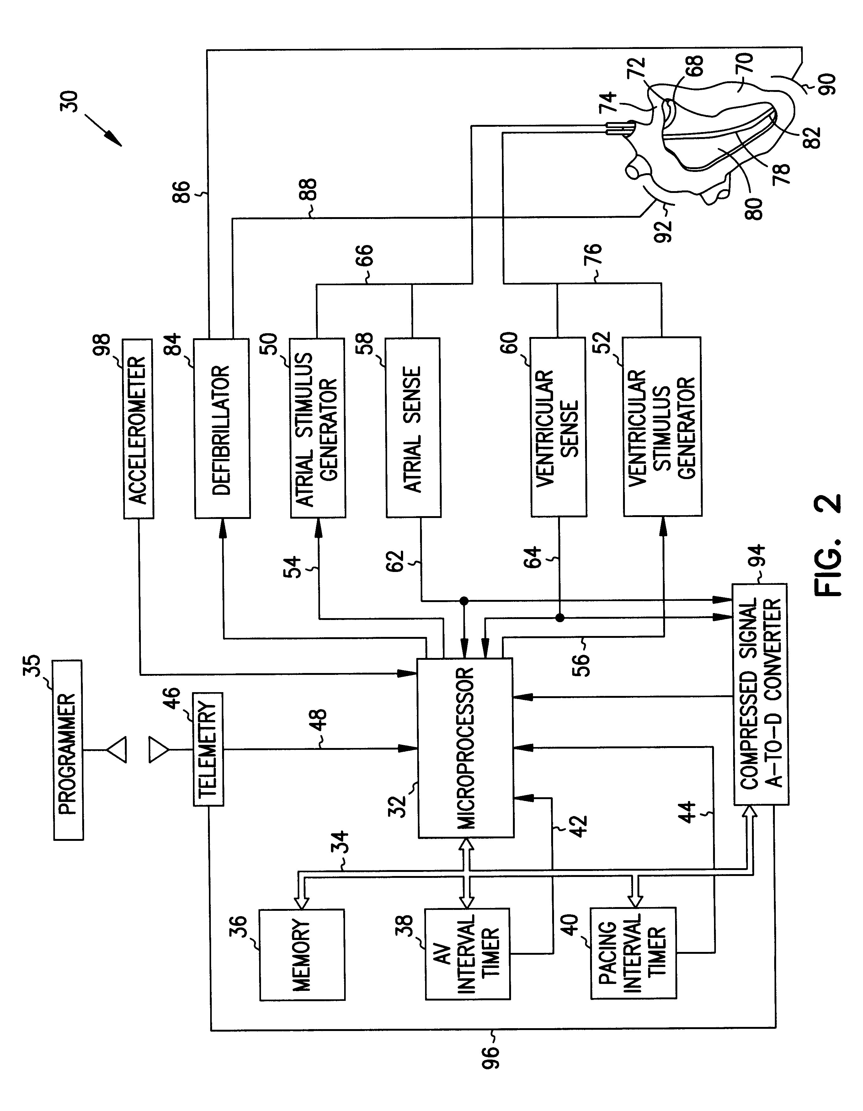 Methods and apparatus for treating fibrillation and creating defibrillation waveforms