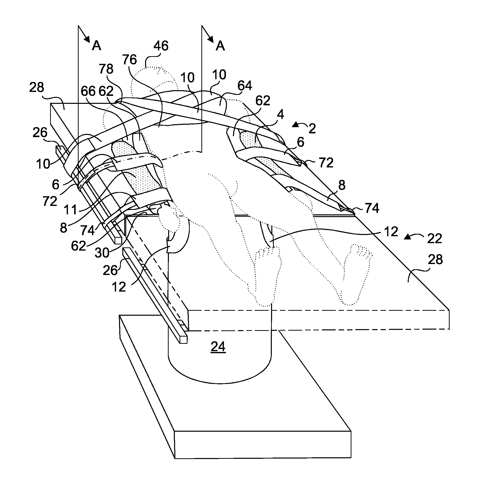 Operating table patient positioner and method