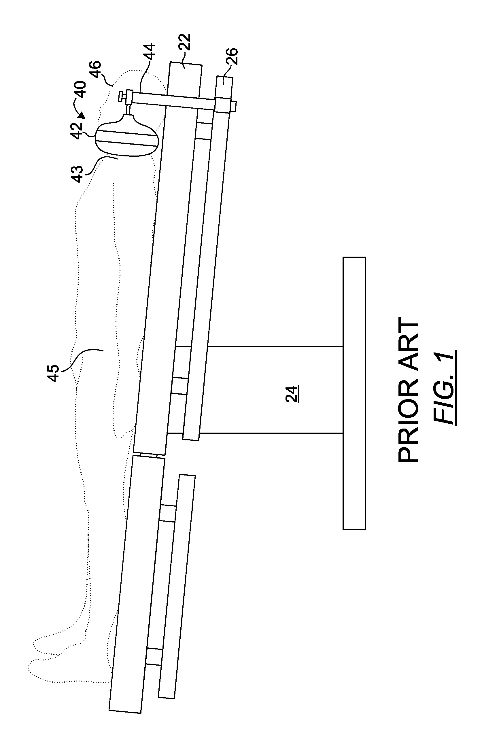 Operating table patient positioner and method