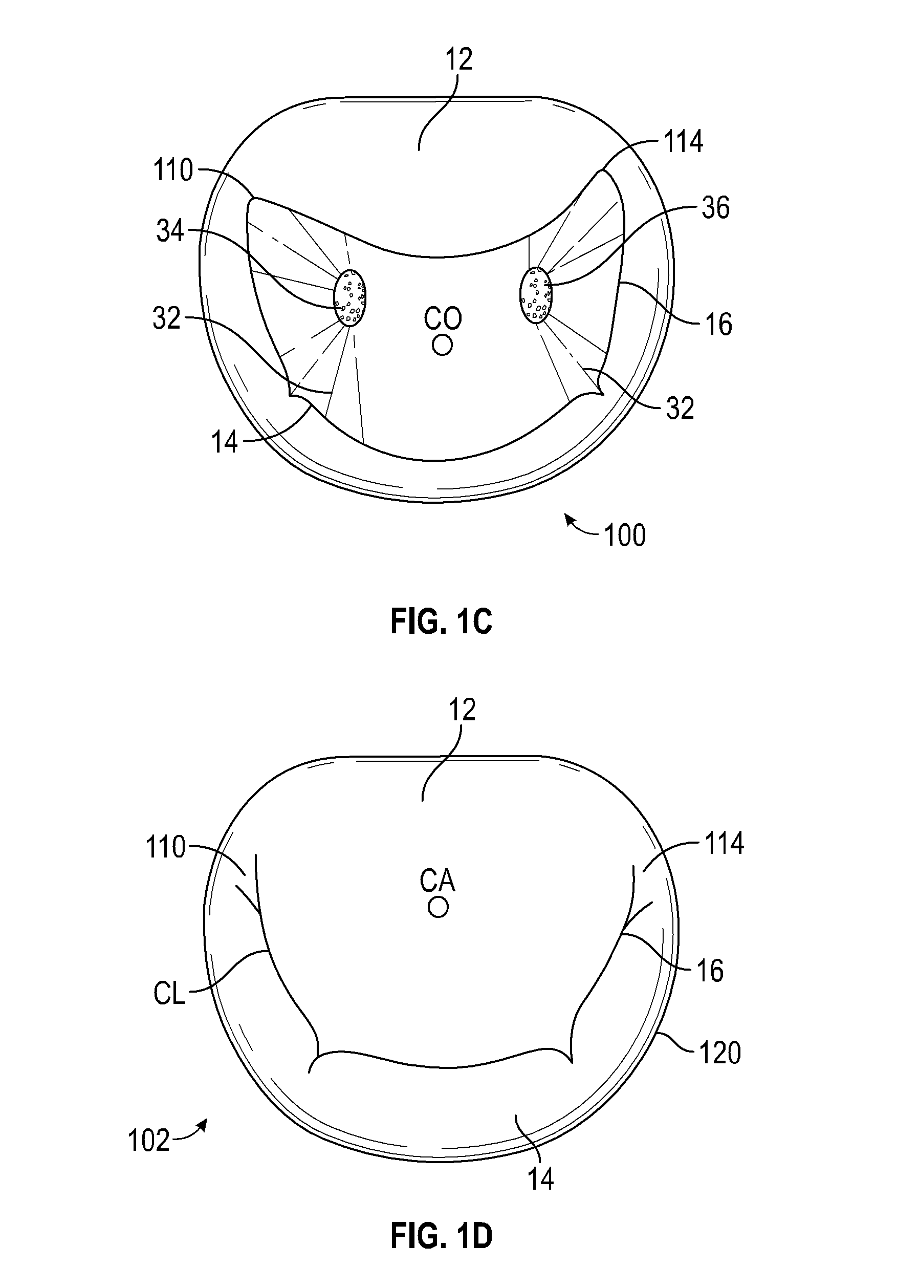 Mitral valve implants for the treatment of valvular regurgitation