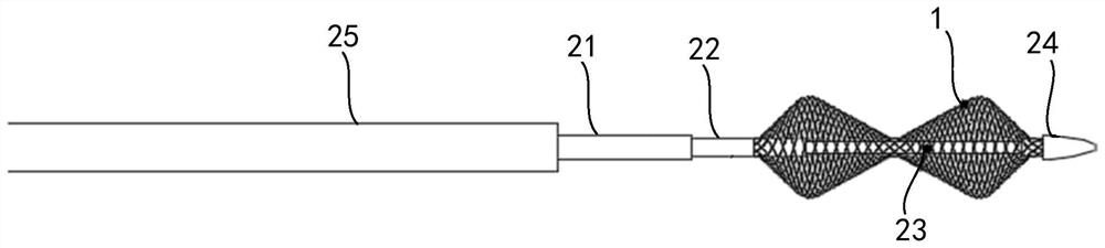 Hemodialysis channel thrombectomy device