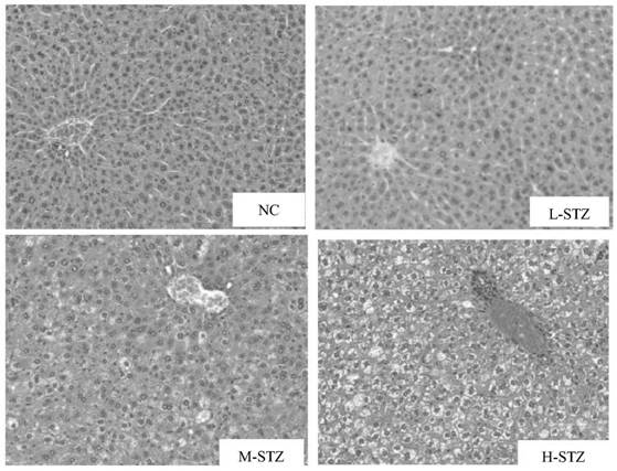 Method for constructing type II diabetes model by combining high-fat feeding with streptozotocin induction