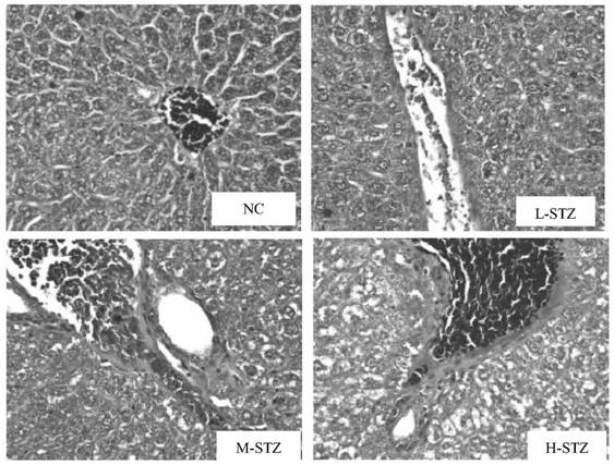 Method for constructing type II diabetes model by combining high-fat feeding with streptozotocin induction