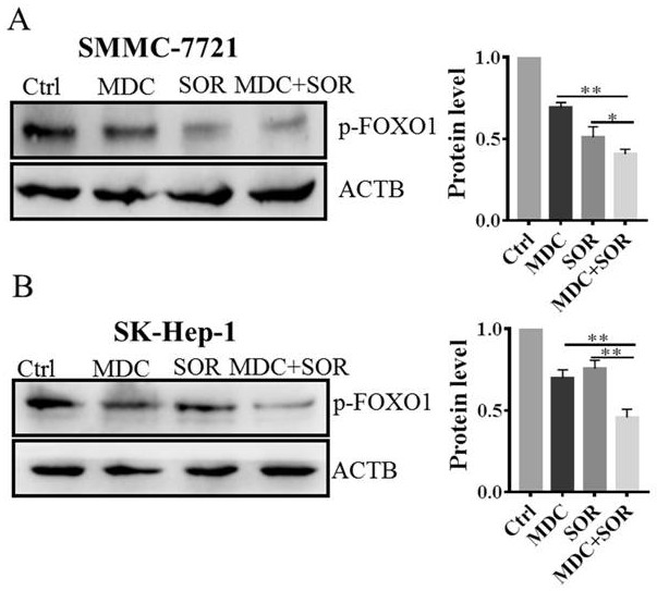 Application of composition of demethylated magnesium cantharidate and sorafenib in preparation of anti-hepatoma drugs