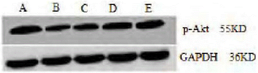 Pharmaceutical composition for treating chronic nephritis