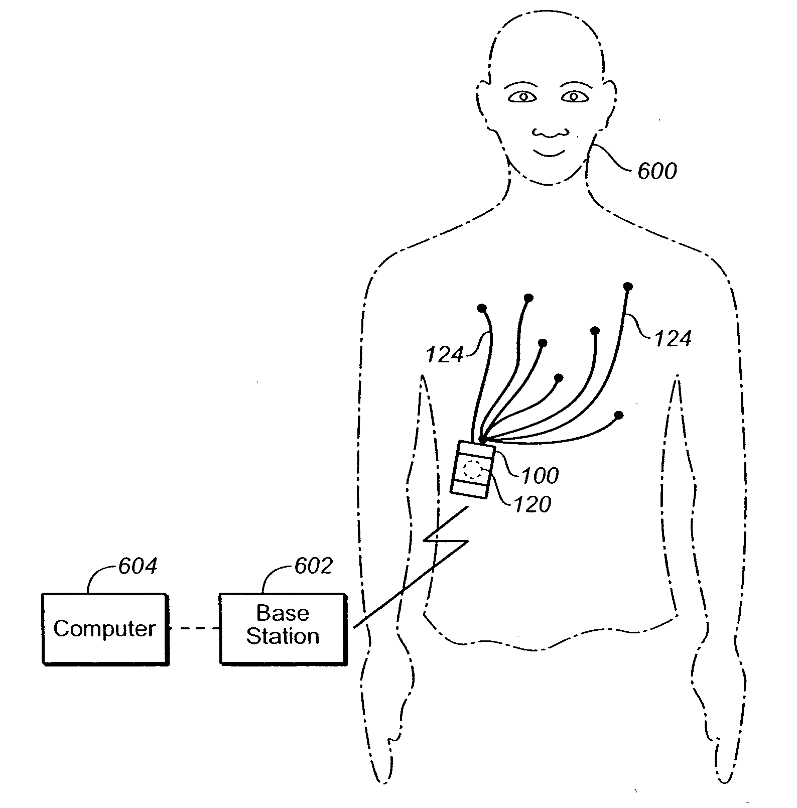 Portable cardiac monitor including a range limiter