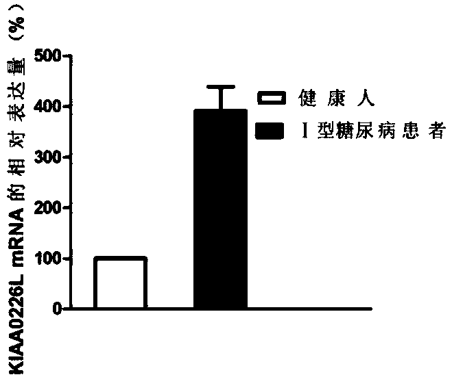 Molecular markers of type I diabetes