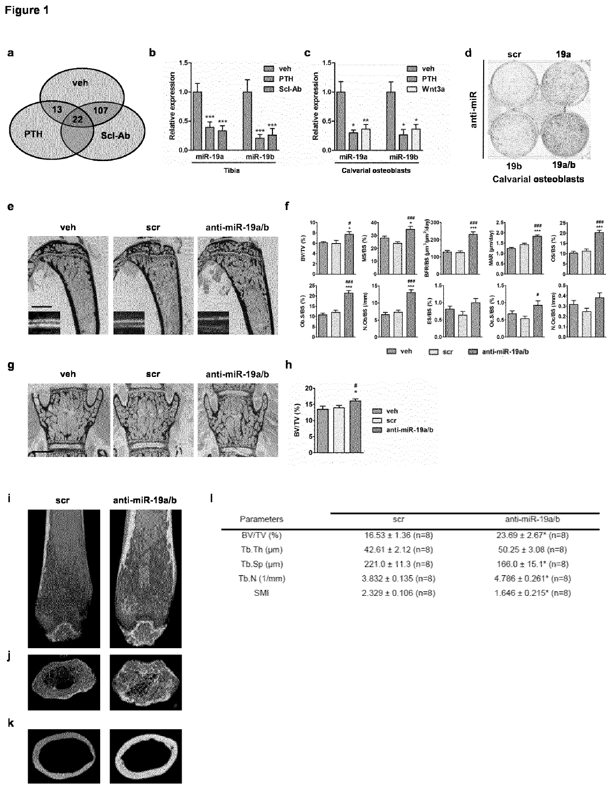 Microrna 19a/19b for use in treating a pathological condition associated with bone loss or reduced muscle function