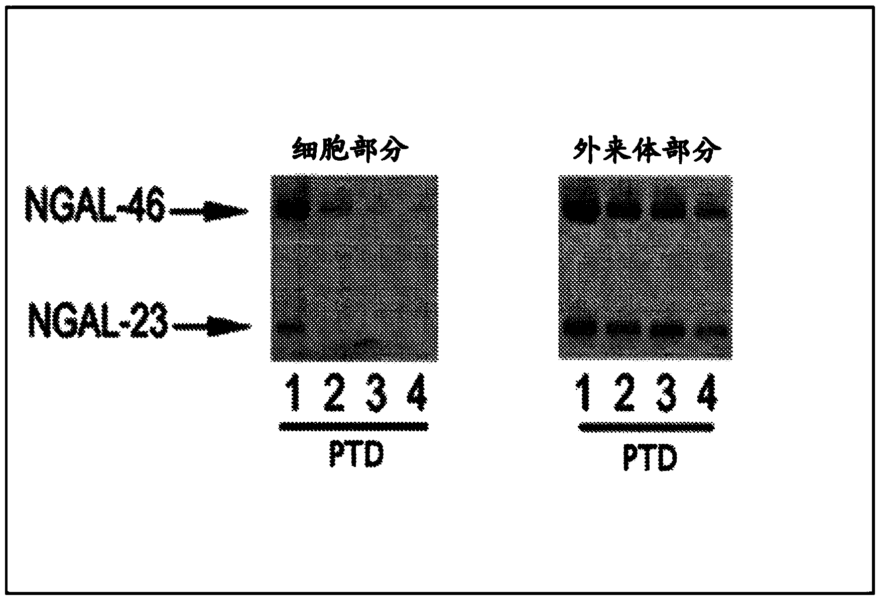 Method for monitoring, diagnosis and/or prognosis of acute kidney injury in early stage