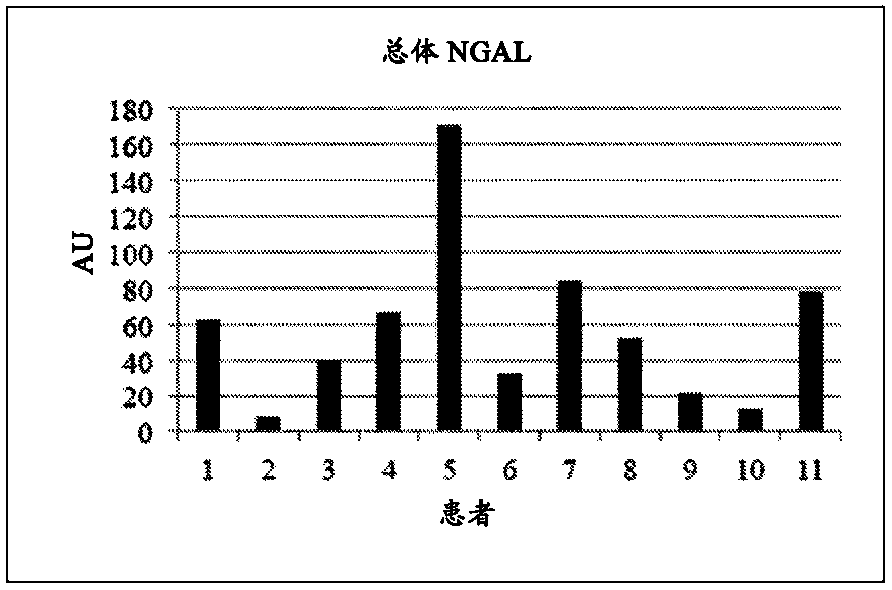 Method for monitoring, diagnosis and/or prognosis of acute kidney injury in early stage