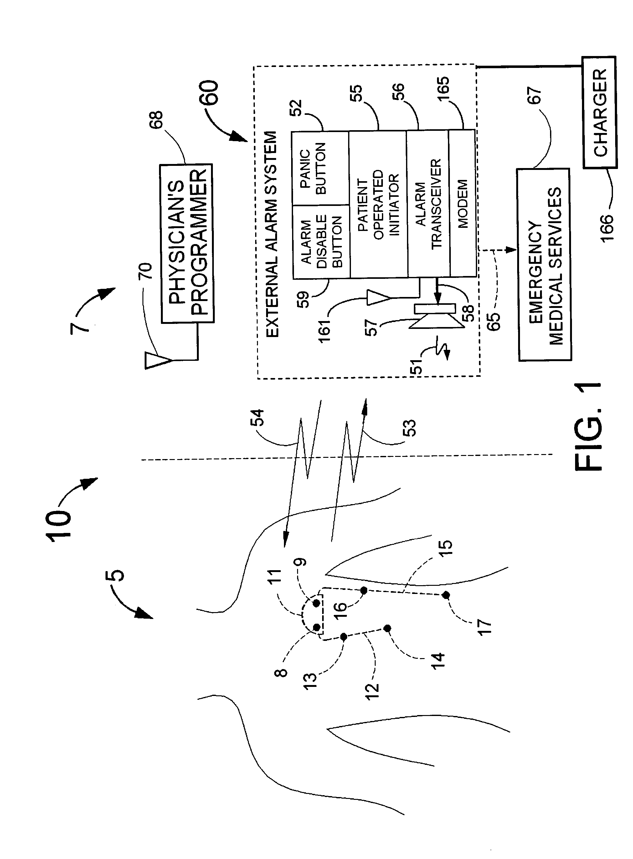 Means and method for the detection of cardiac events