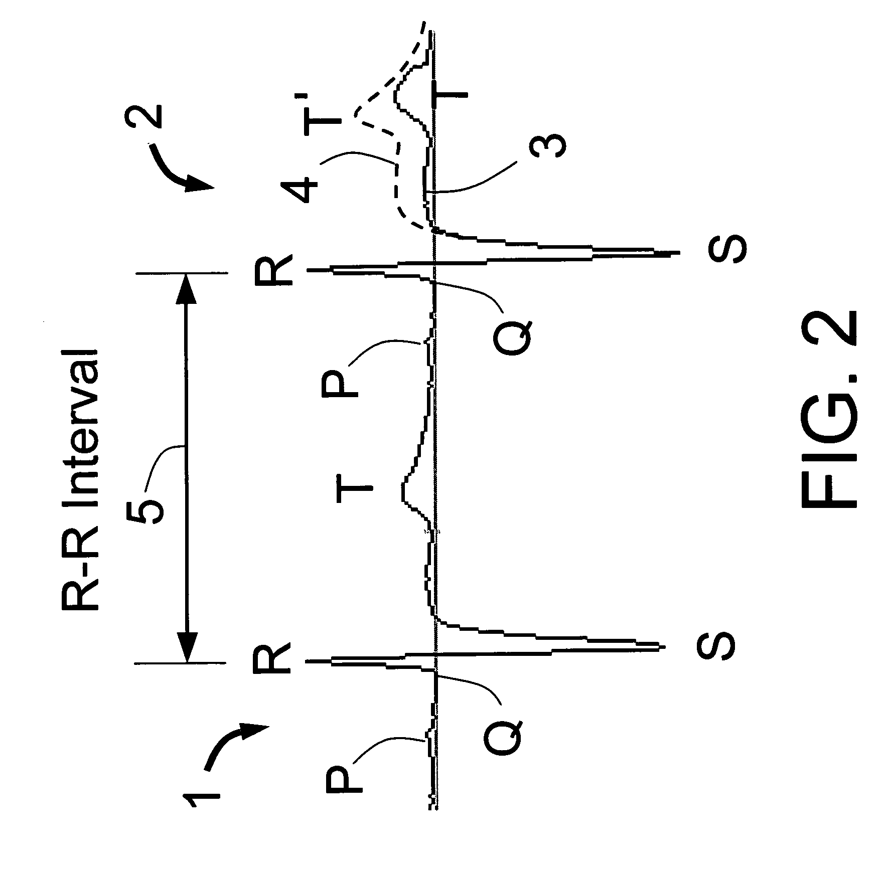 Means and method for the detection of cardiac events