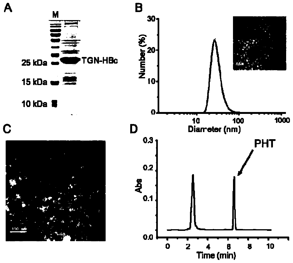 Brain-targeted drug-delivery system, brain-targeted drug, and preparation methods of brain-targeted drug-delivery system and brain-targeted drug