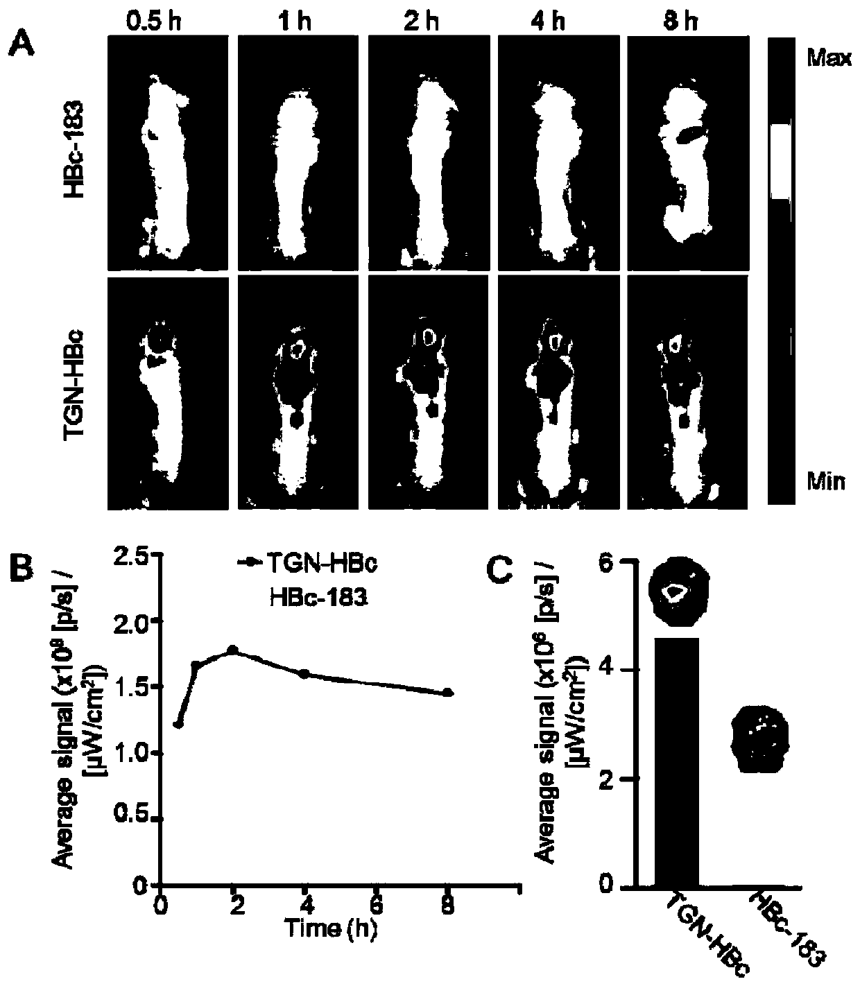 Brain-targeted drug-delivery system, brain-targeted drug, and preparation methods of brain-targeted drug-delivery system and brain-targeted drug