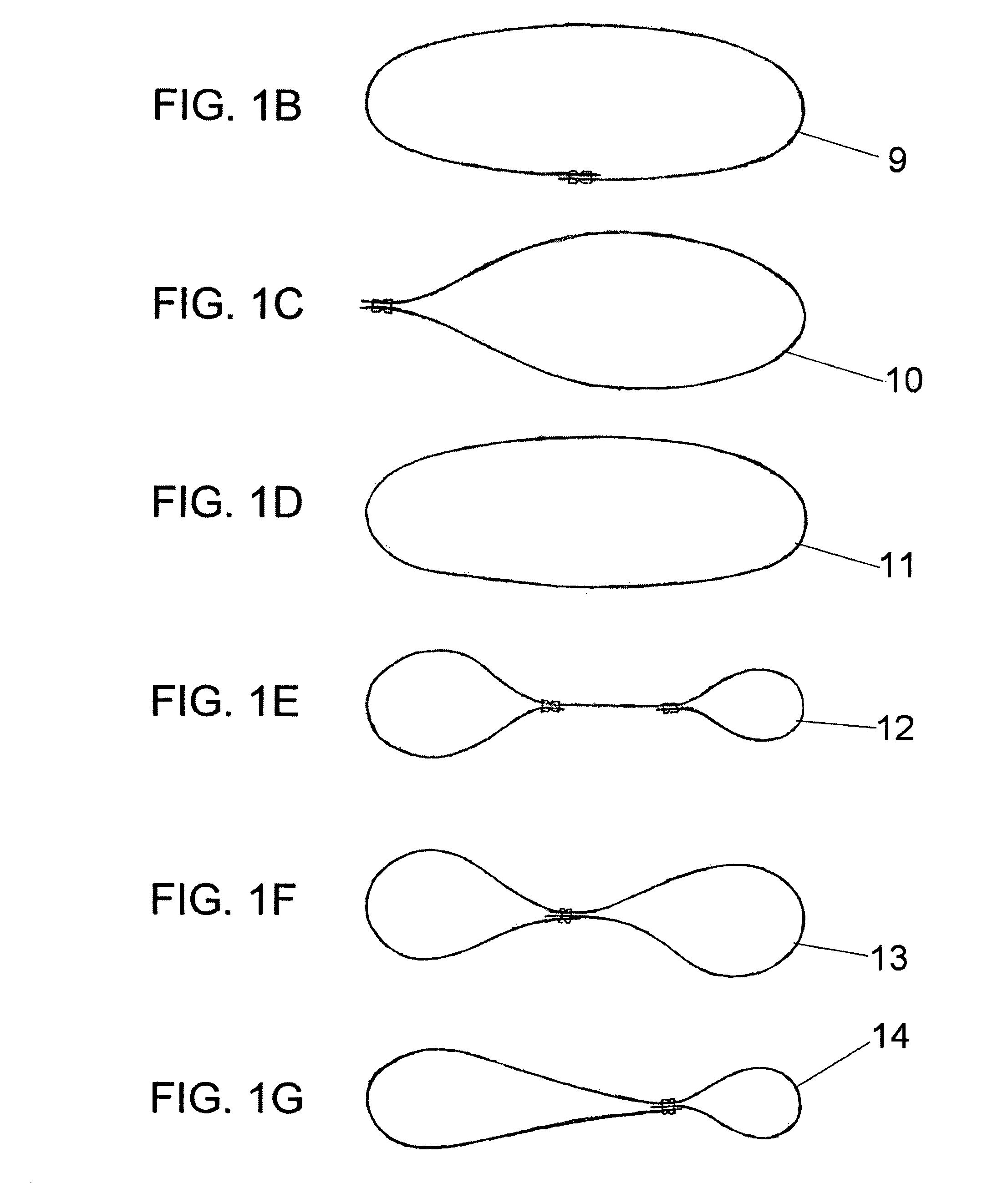 Ostomy tube device, ostomy placement kit and method for an ostomy tube placement