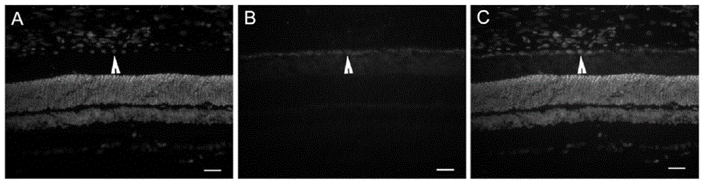 Application of a lentivirus carrying neuritin gene in the preparation of drugs for repairing retinal pigment epithelial degeneration