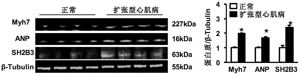 The function and application of sh2b adapter protein 3 (sh2b3) in the treatment of cardiac hypertrophy