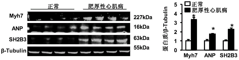 The function and application of sh2b adapter protein 3 (sh2b3) in the treatment of cardiac hypertrophy