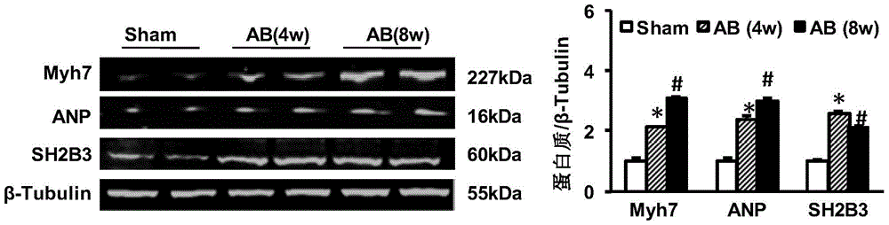 The function and application of sh2b adapter protein 3 (sh2b3) in the treatment of cardiac hypertrophy