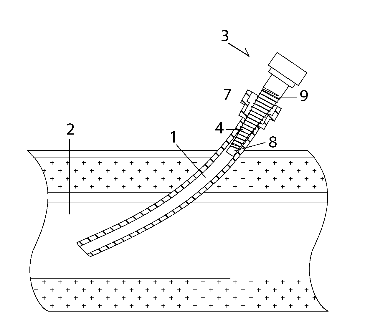 Adapter for an introducer