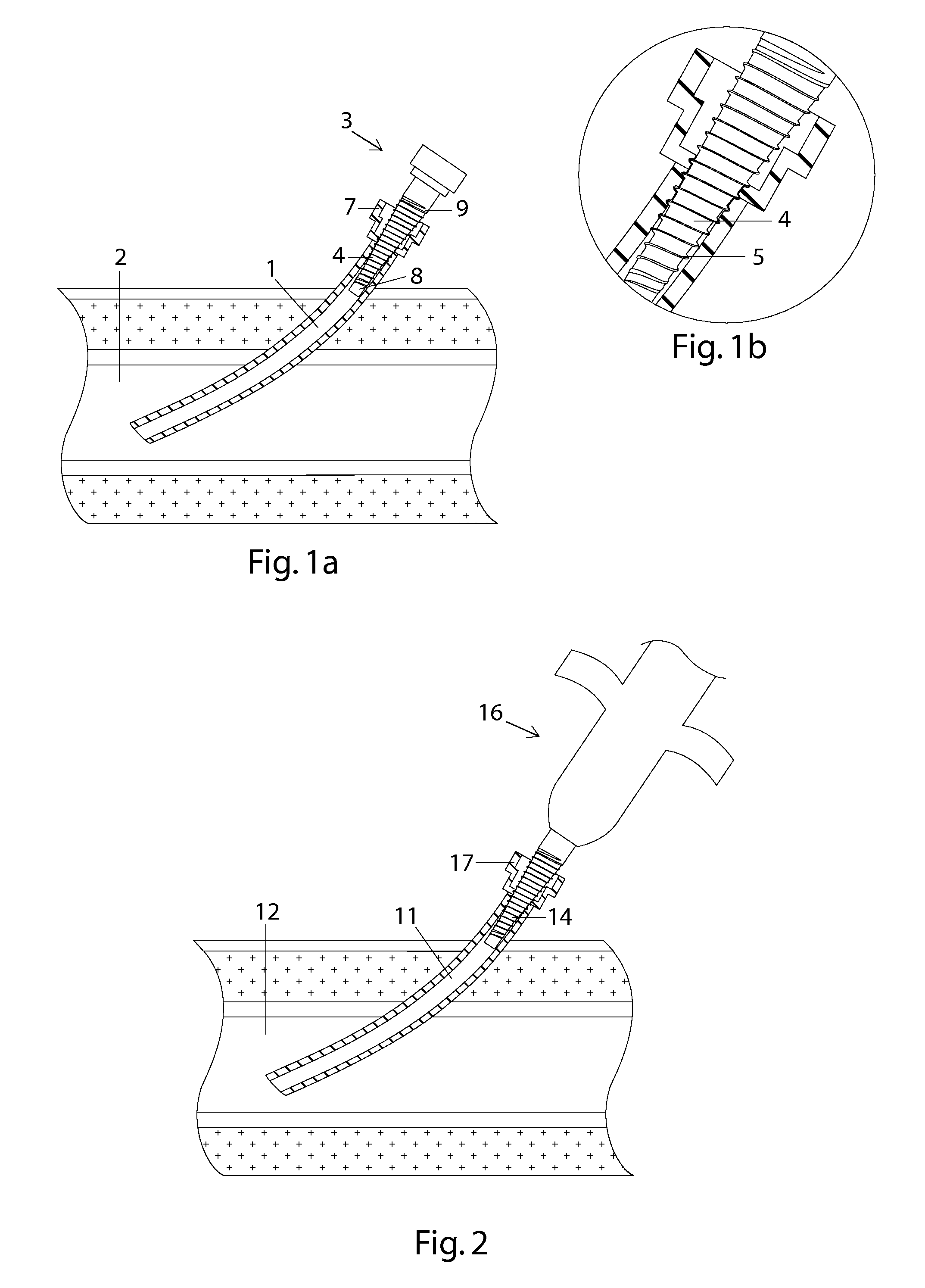 Adapter for an introducer