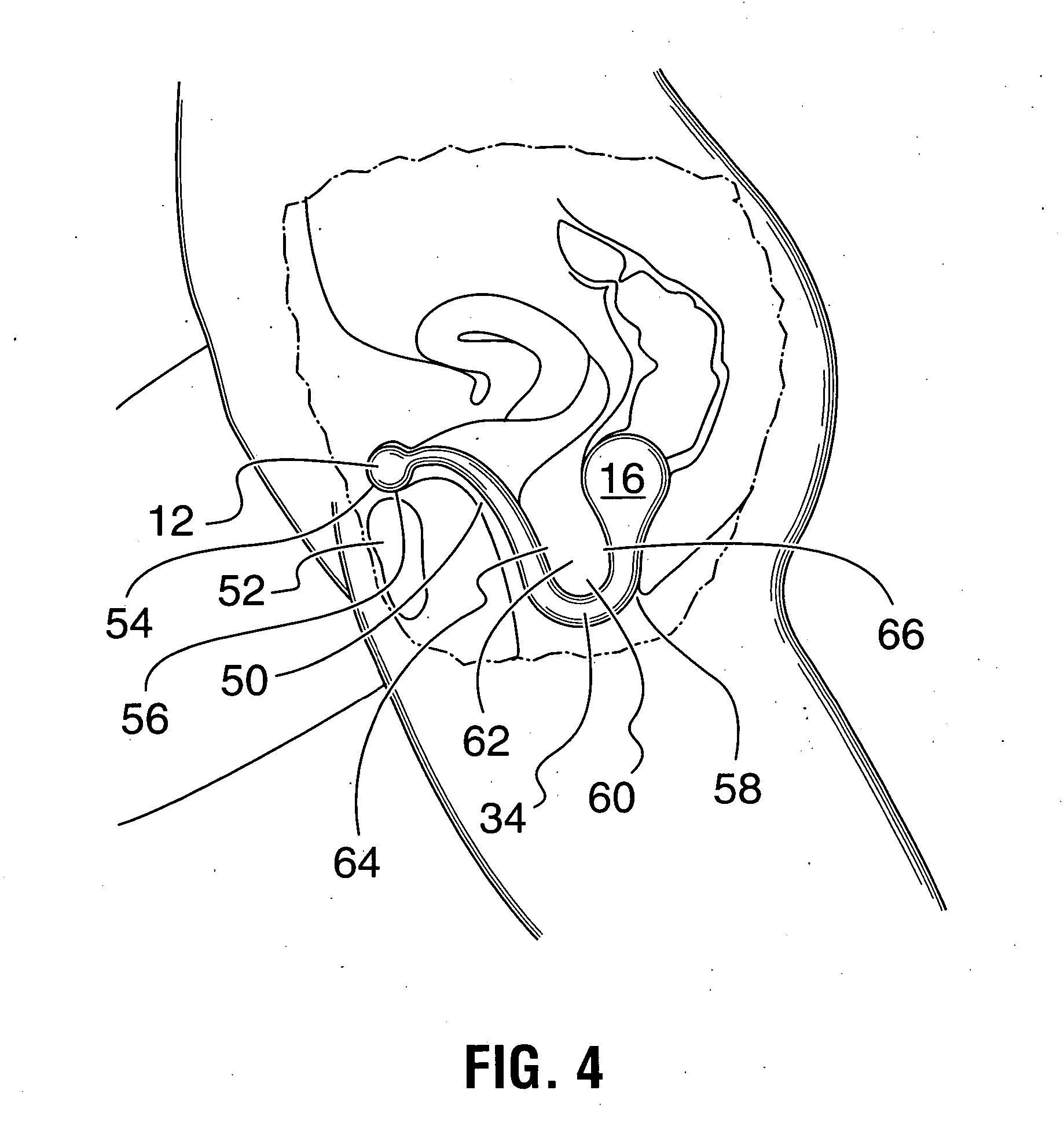 Kegel muscle exercising device and method for exercising Kegel muscle