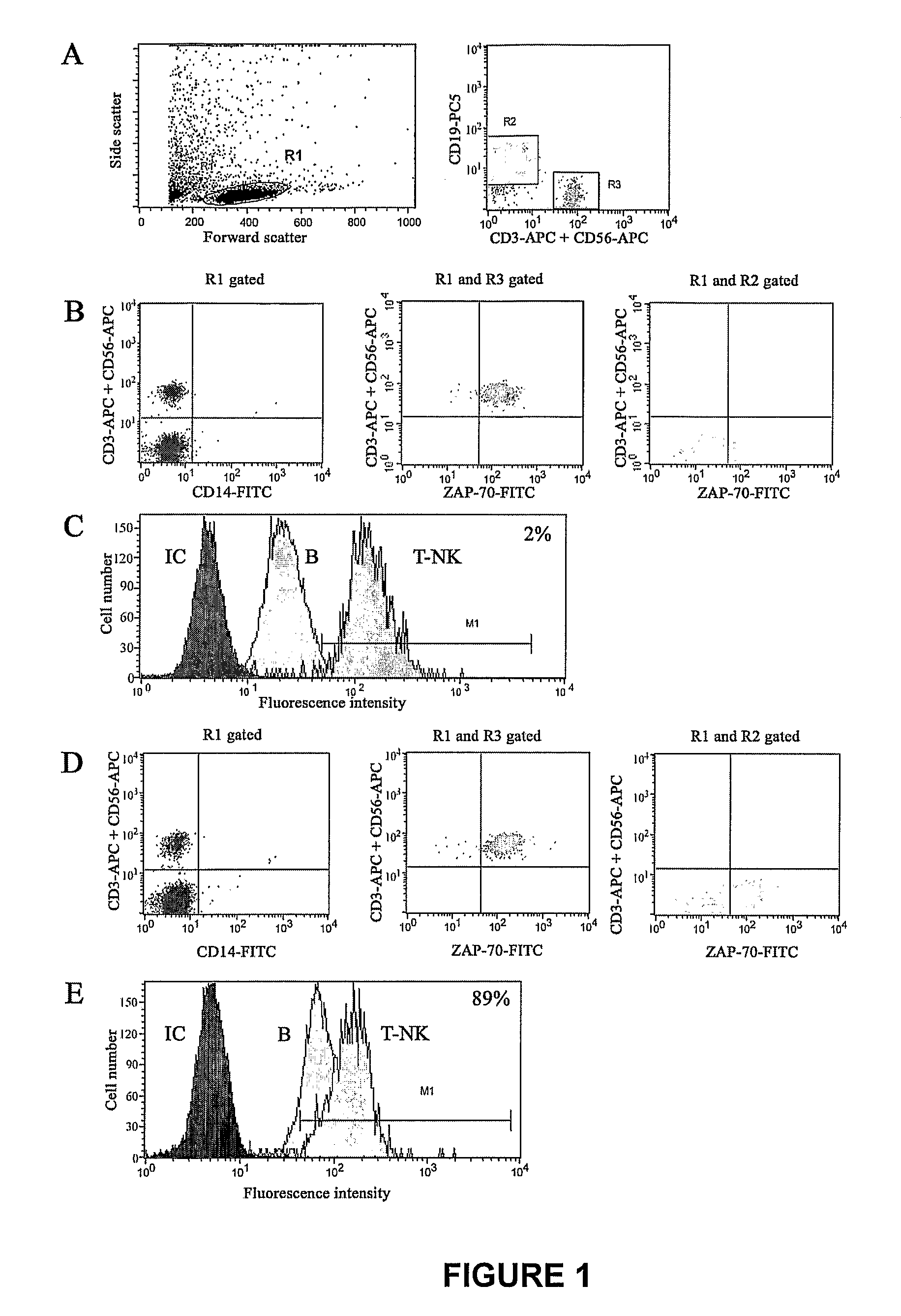 Method of Diagnosis/Prognosis of Human Chronic Lymphocytic Leukemia Comprising the Profiling of Lpl/Adam Genes