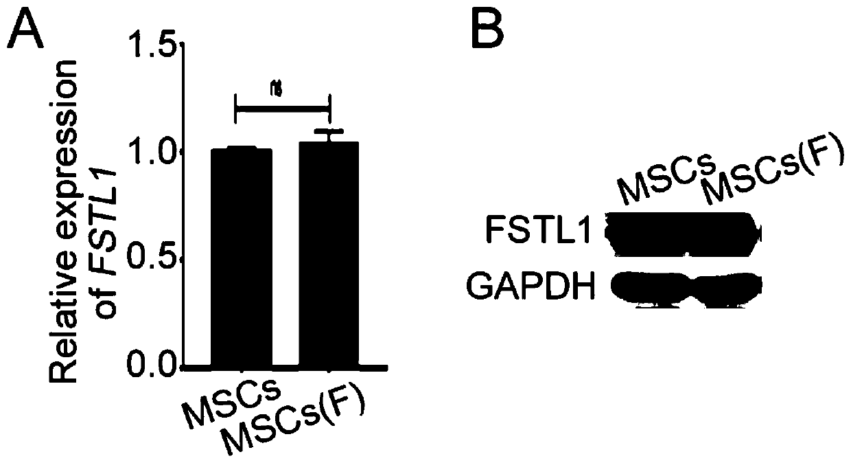 Preparation method of improved mesenchymal stem cells and application thereof