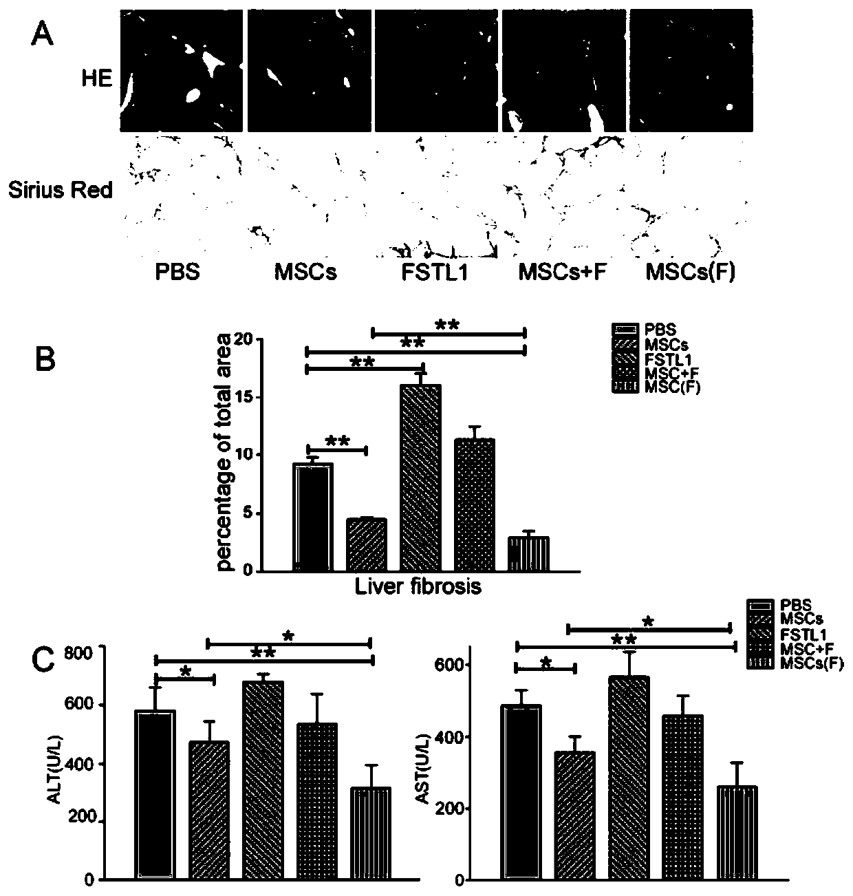 Preparation method of improved mesenchymal stem cells and application thereof