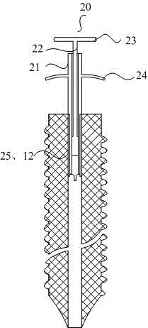 Hollow screw structure and usage thereof