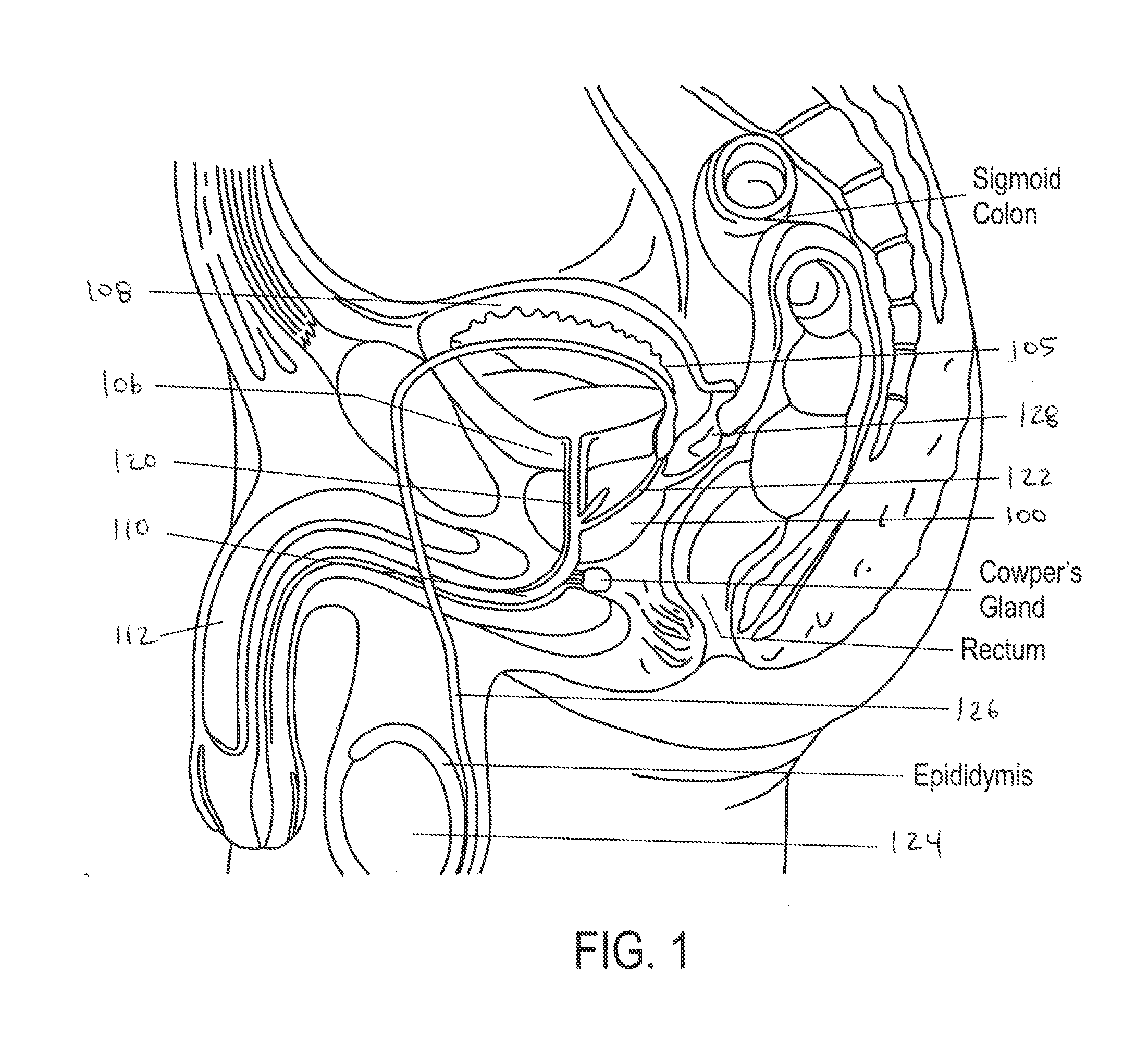 Systems and Methods for Prostate Treatment