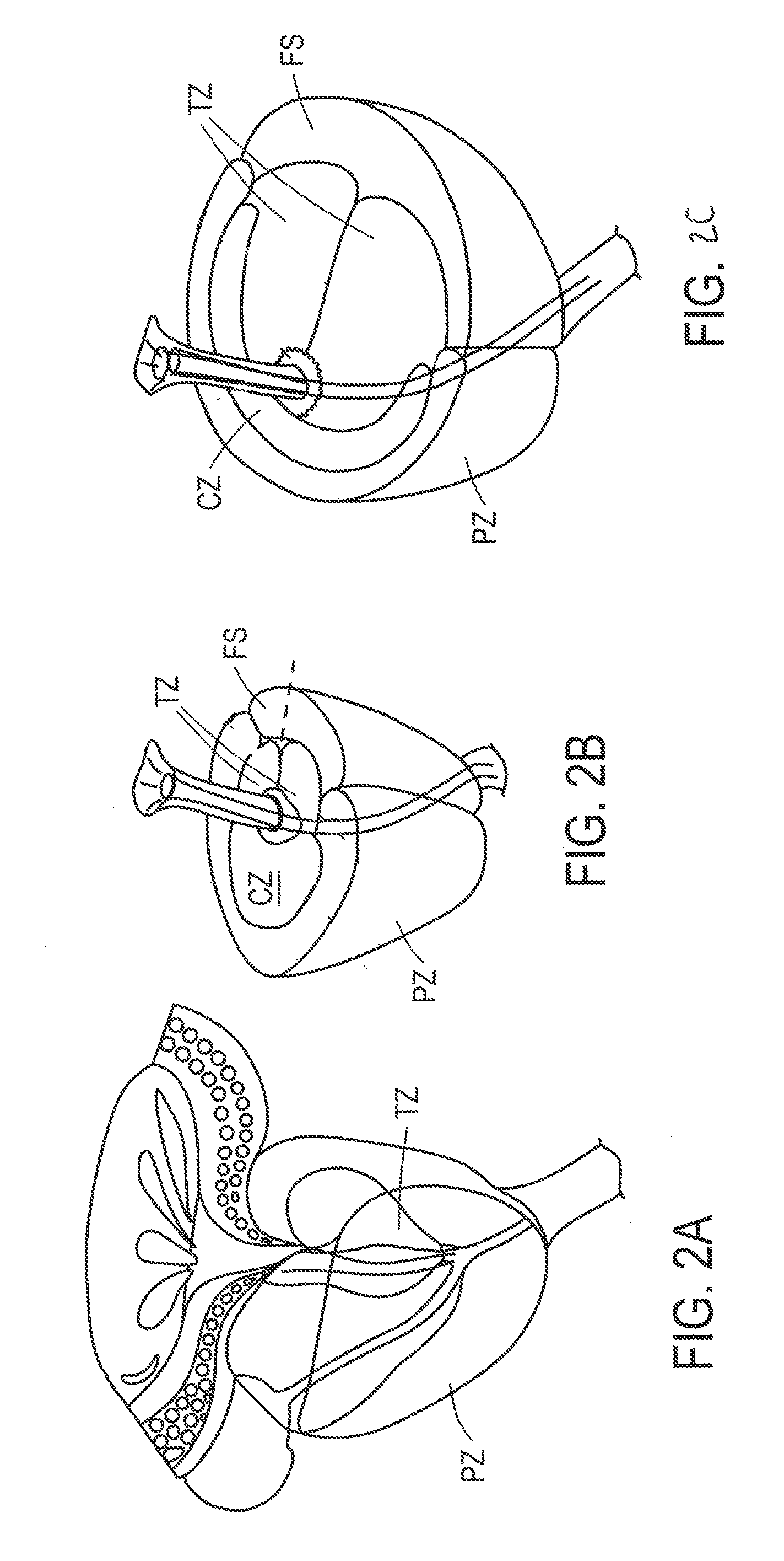 Systems and Methods for Prostate Treatment