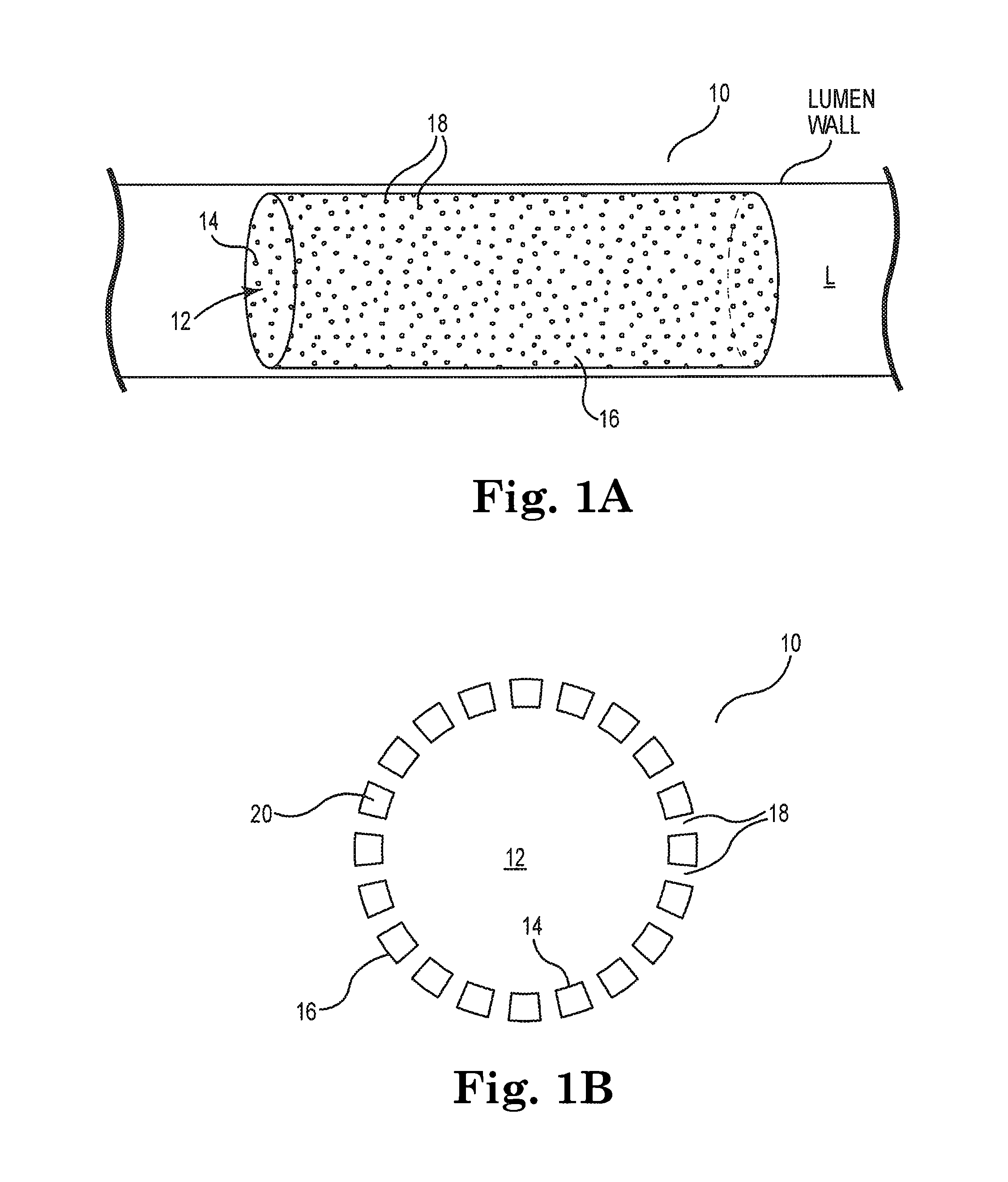 Therapeutic agent delivery system and method for localized application of therapeutic substances to a biological lumen