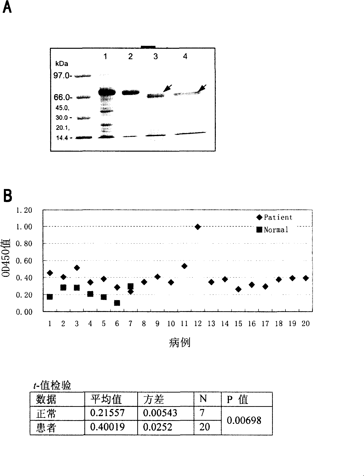 Novel anti-plasmodium falciparum epitope and vaccine containing the same