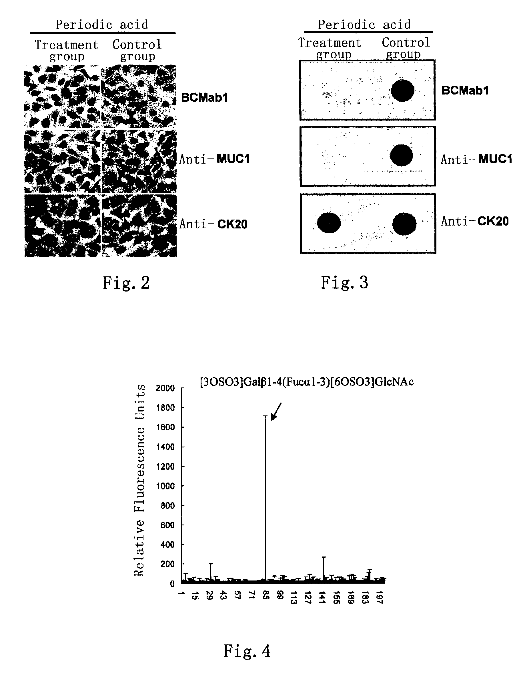 Bladder cancer tumor marker, antibody and use thereof