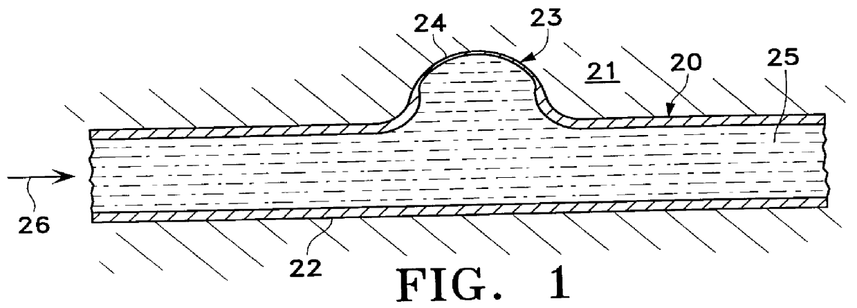 Apparatus for treating aneurysms with a thermal source