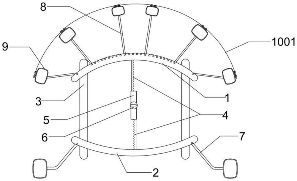 An orthodontic device combining front traction and molar remote movement