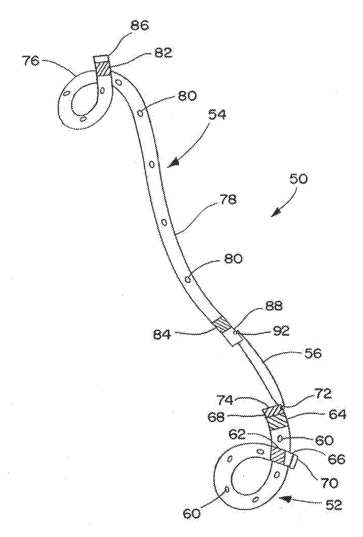 Ureteral stent for placement in a kidney and bladder