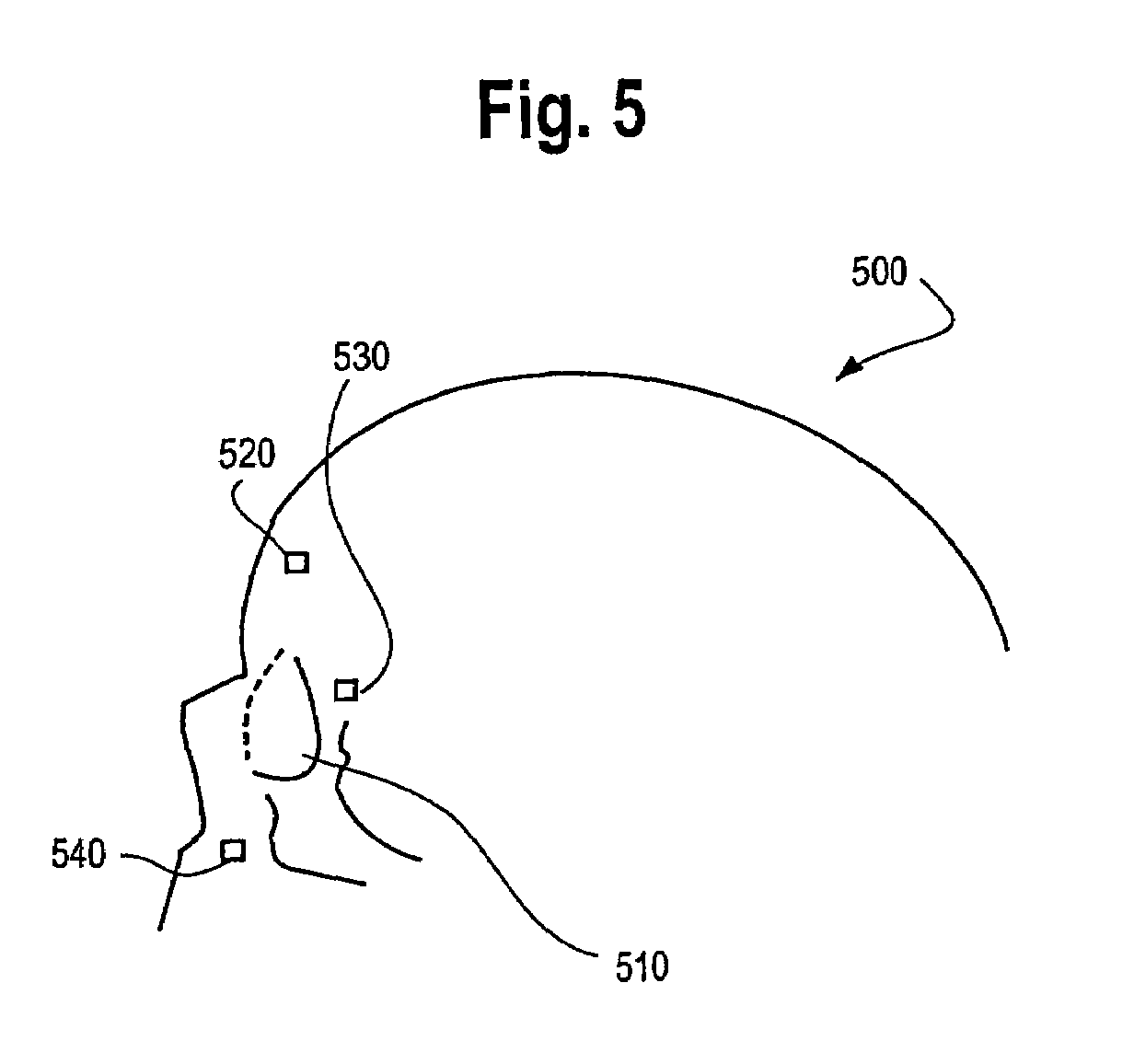 Photodynamic therapy treatment for eye disease