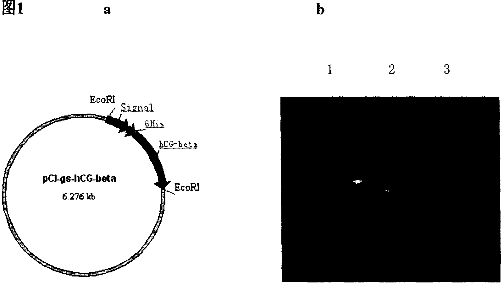 Method for preparing human chorion gonadotrophic hormone beta subunit