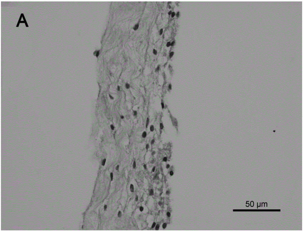 Acellular matrix material based on adipose-derived stem cell sheet and preparation method of acellular matrix material