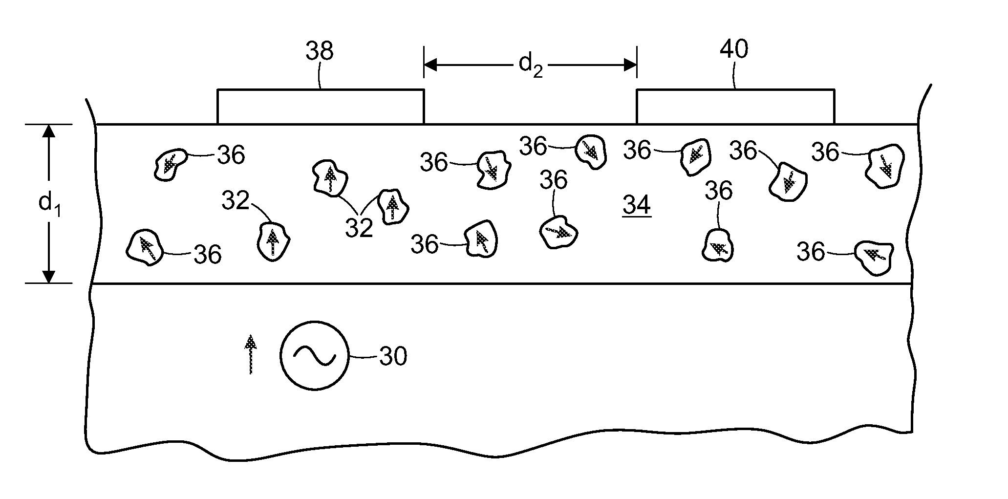 High impedance signal detection systems and methods for use in electrocardiogram detection systems