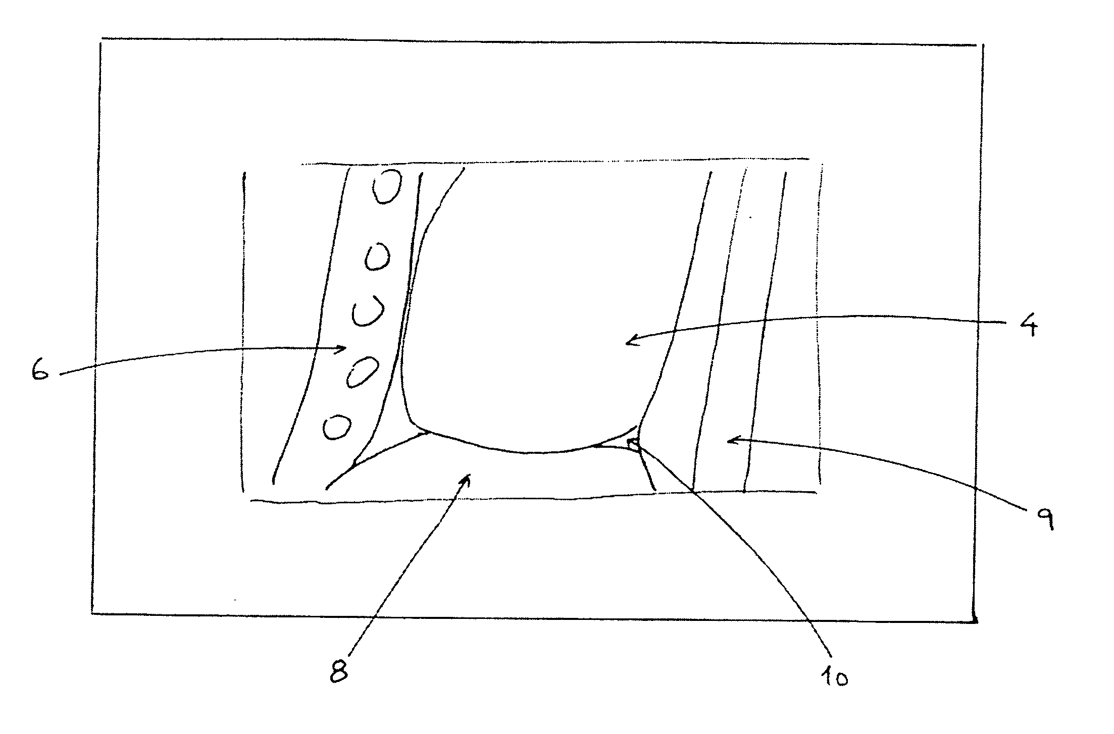 Method and system for processing an image of body tissues